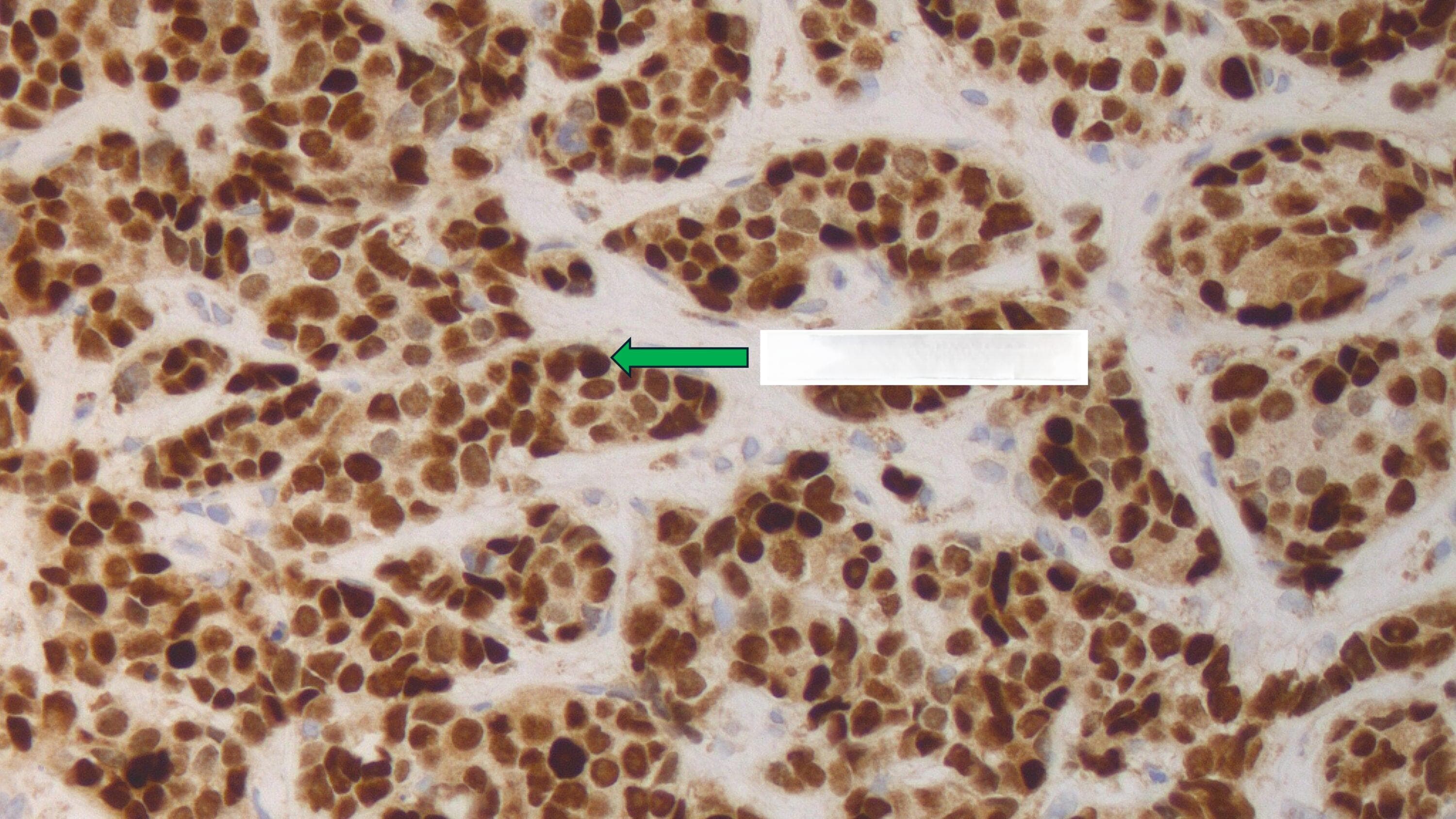 免疫组织化学 (IHC)
