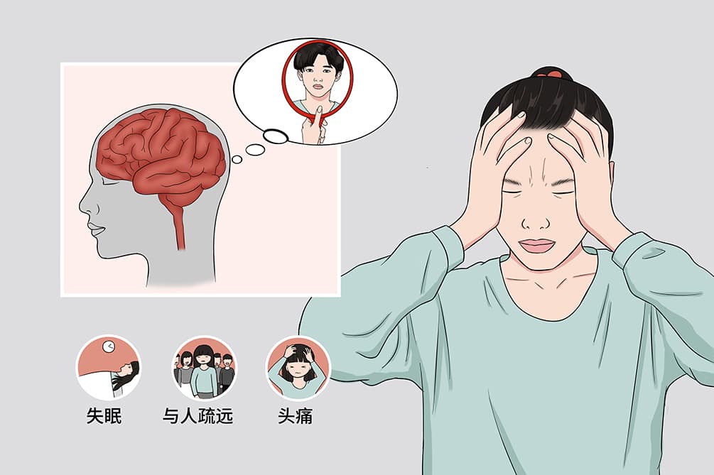 臆想症：病因、症状与治疗全解析