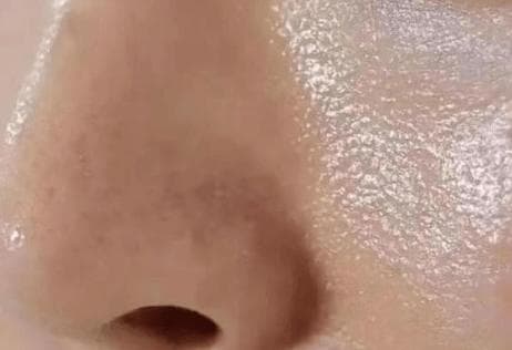 告别油皮烦恼：如何平衡肌肤油脂分泌