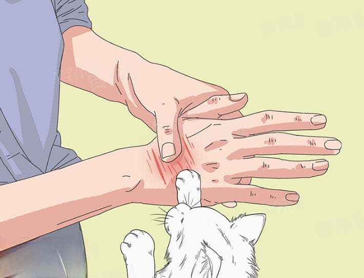 被猫抓伤后的正确处理方法