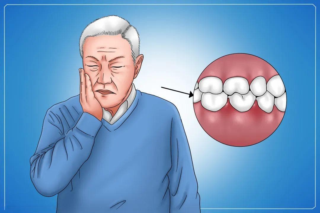 有医说医 | 老年人拔牙前应该知道的那些事儿