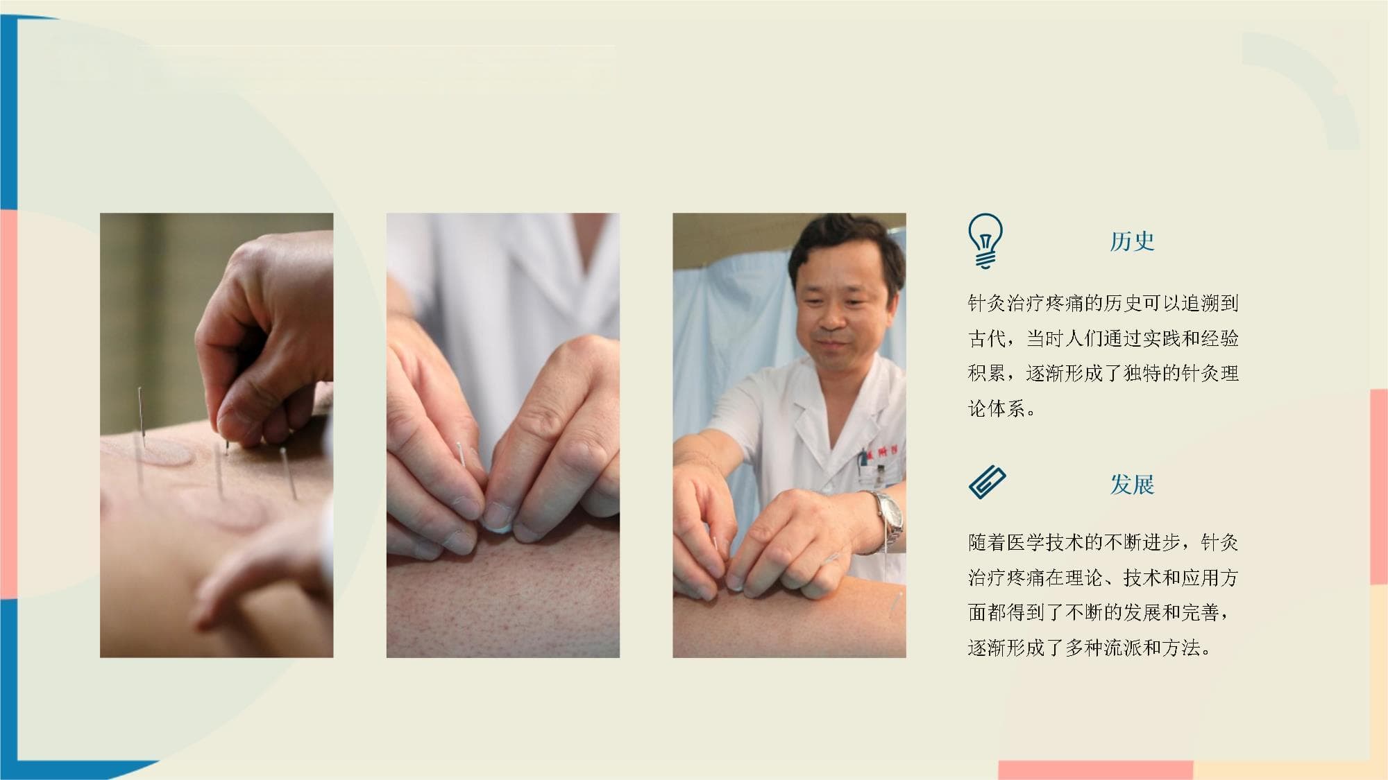 针灸治疗疼痛的作用机理与临床应用