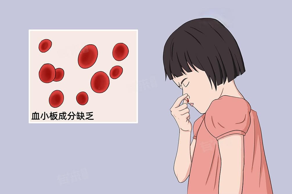 儿童血小板低的原因及应对方法