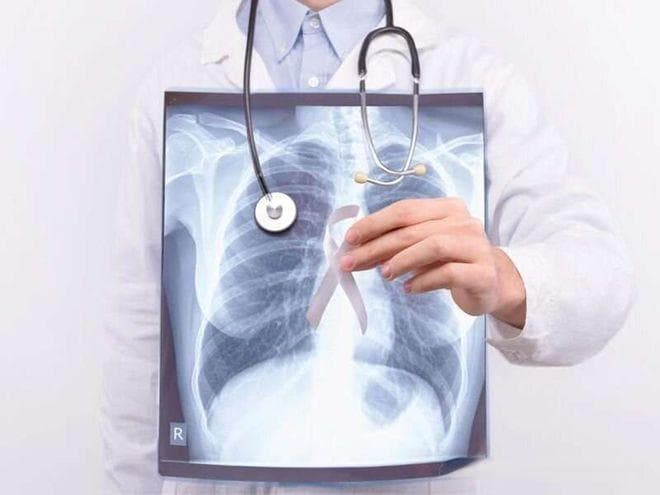 彻底戒烟多少年之后，你罹患癌症的风险才可能降低？