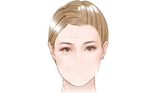 脂肪胶和脂肪填充哪个好？两者在成分、结果、适用范围等方面存在显著差异！