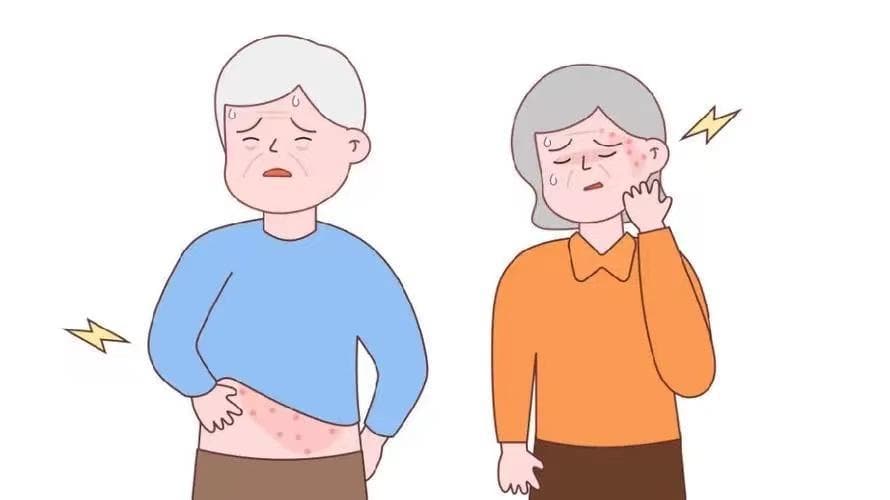 带状疱疹：从病因到预防的全面解析