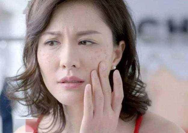 都是50岁！为何有些人皮肤上的老年斑「密密麻麻」，有的却很干净？医生说出实情