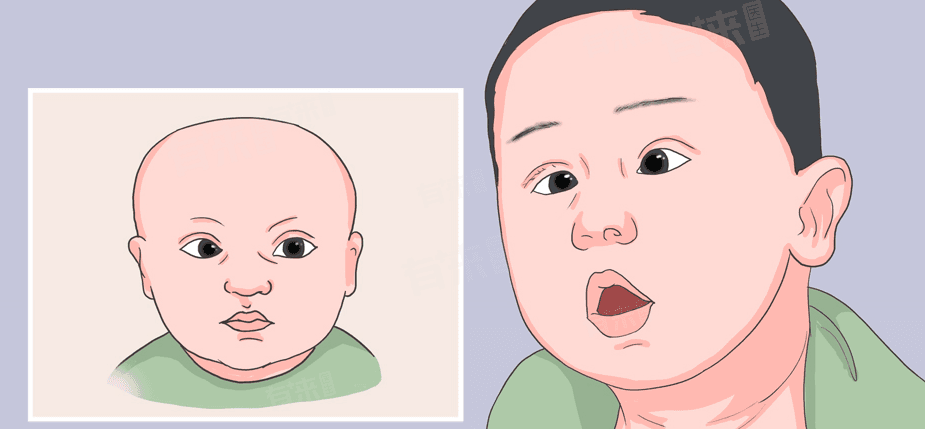 小孩斗鸡眼怎么矫正