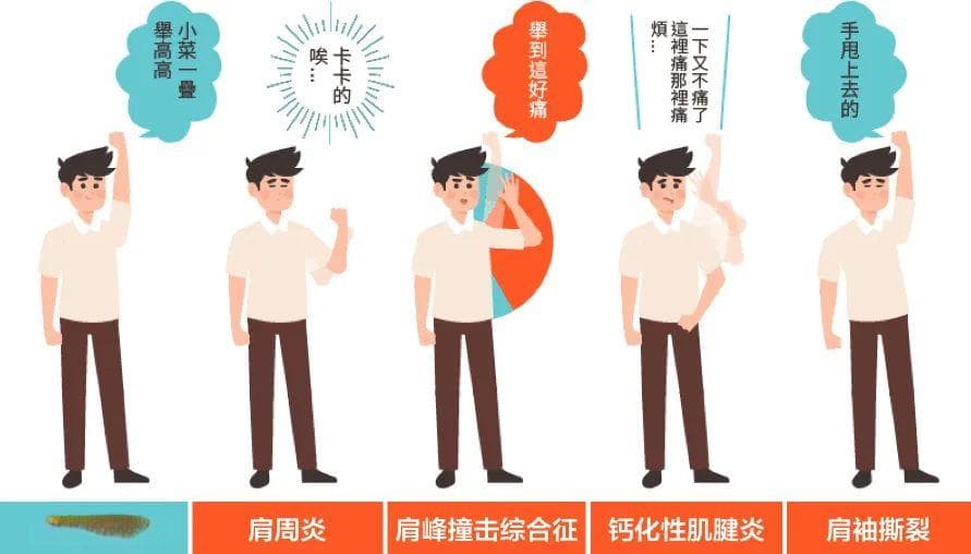 肩痛不一定是肩部问题，颈痛也不一定是颈部问题？