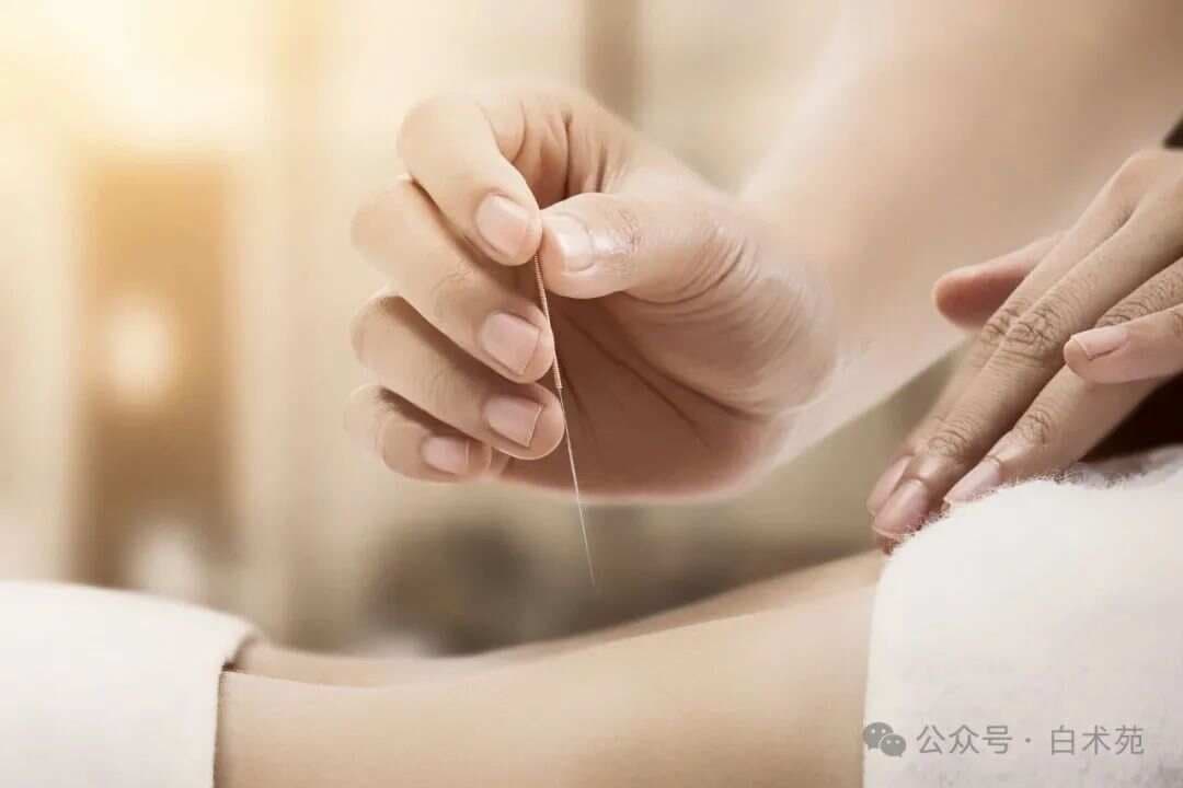 针灸之道：那些不可忽视的禁忌