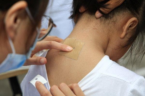 急性腰扭伤的针灸治疗腰痛点