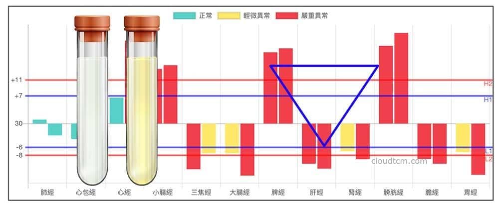 从尿液七种颜色与状态，探讨经络与疾病讯号