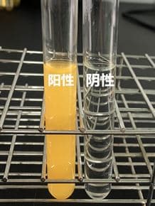 班氏试剂的使用原理及结果判定