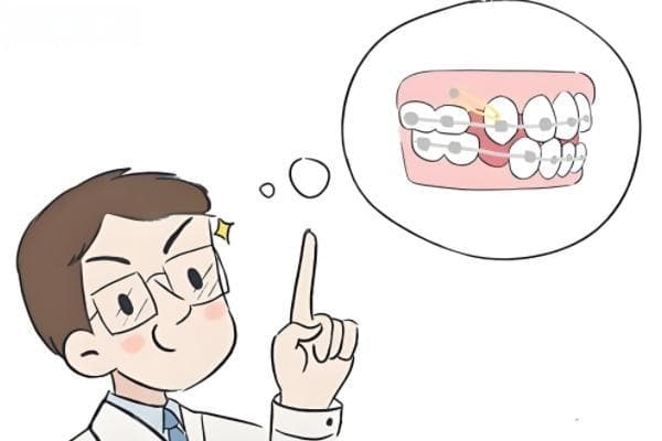 矫正不按时复诊会怎么样？延误正畸周期还有更复杂危害