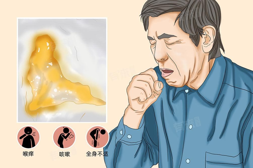痰多是怎么回事？如何有效去痰？