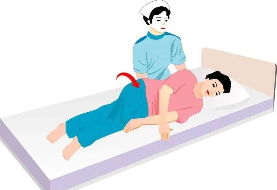 结直肠癌患者的居家护理和康复指南