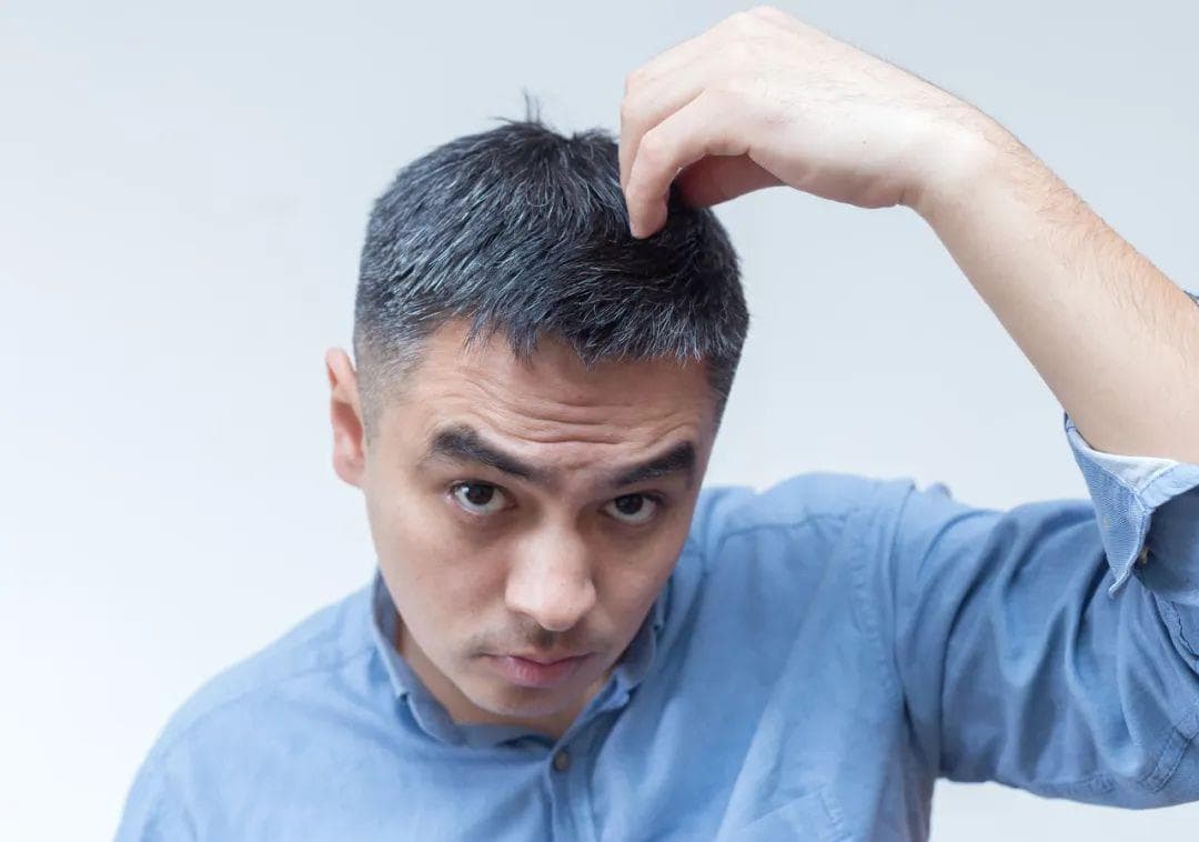 头发白了，还能变黑吗？医生的答案出乎意料