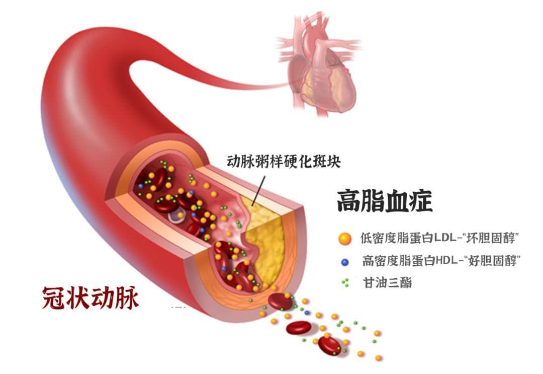 维生素B3(烟酸)：血脂天然调节剂