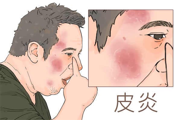 身体突然很痒是什么原因