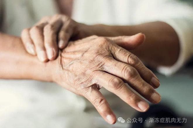 渐冻症治疗有门道，掌握这些要点竟能让患者的疗效更上一层楼！