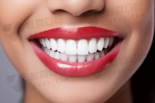 如何有效进行牙齿美白？有哪些方法可以让牙齿更亮白？
