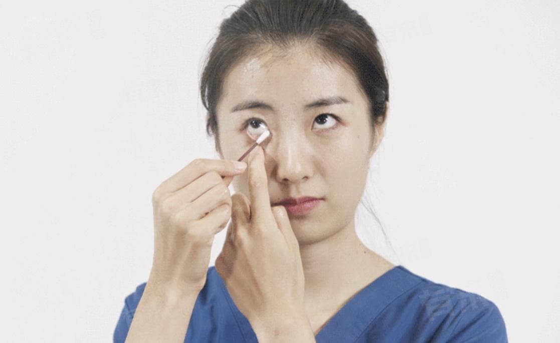 眼睛长眼屎是什么原因