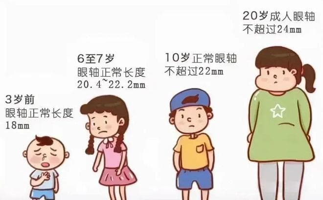 眼轴，眼睛发育“金标准”！