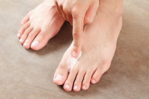 脚气怎么让脚变干燥