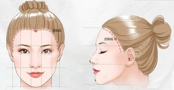 如何判断是先天发际线高还是后移了?几个自测界定标准教你