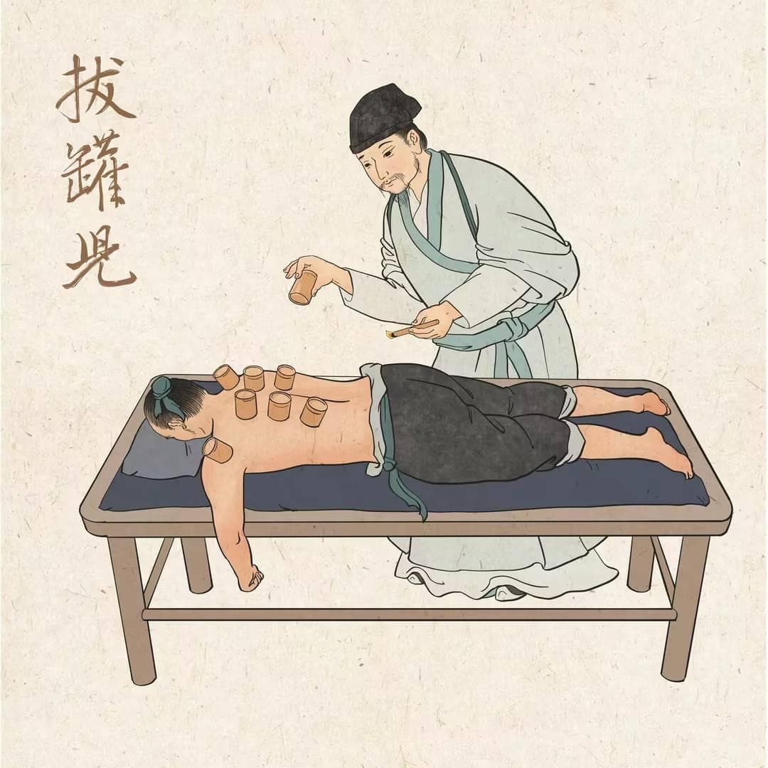 不同体质如何选择拔罐疗法？