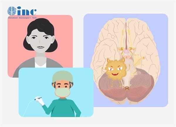脑干肉芽肿：病因、症状、检查、治疗与护理全解析