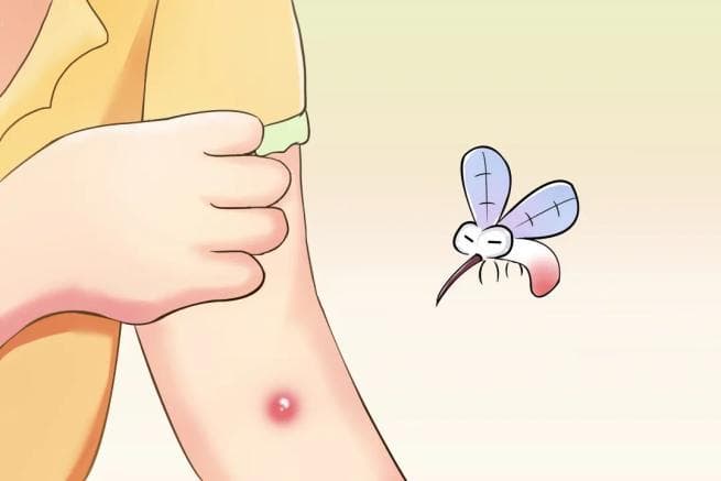 你是招蚊子体质吗？收好这份夏季防蚊攻略