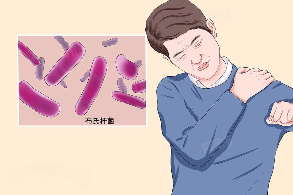 布鲁氏菌病的三种主要传播途径