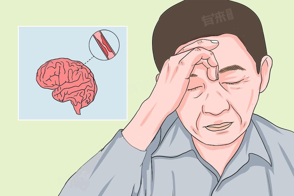 脑血管狭窄做支架好还是保守治疗好