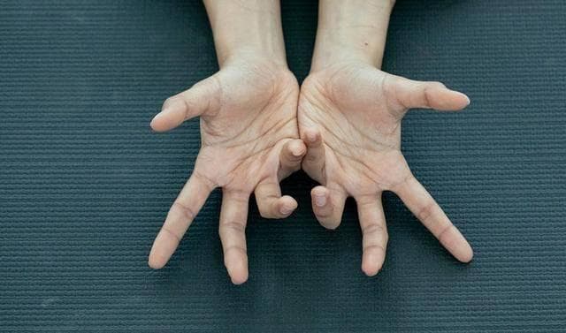 鱼鳞病全解析：从症状识别到治疗方案