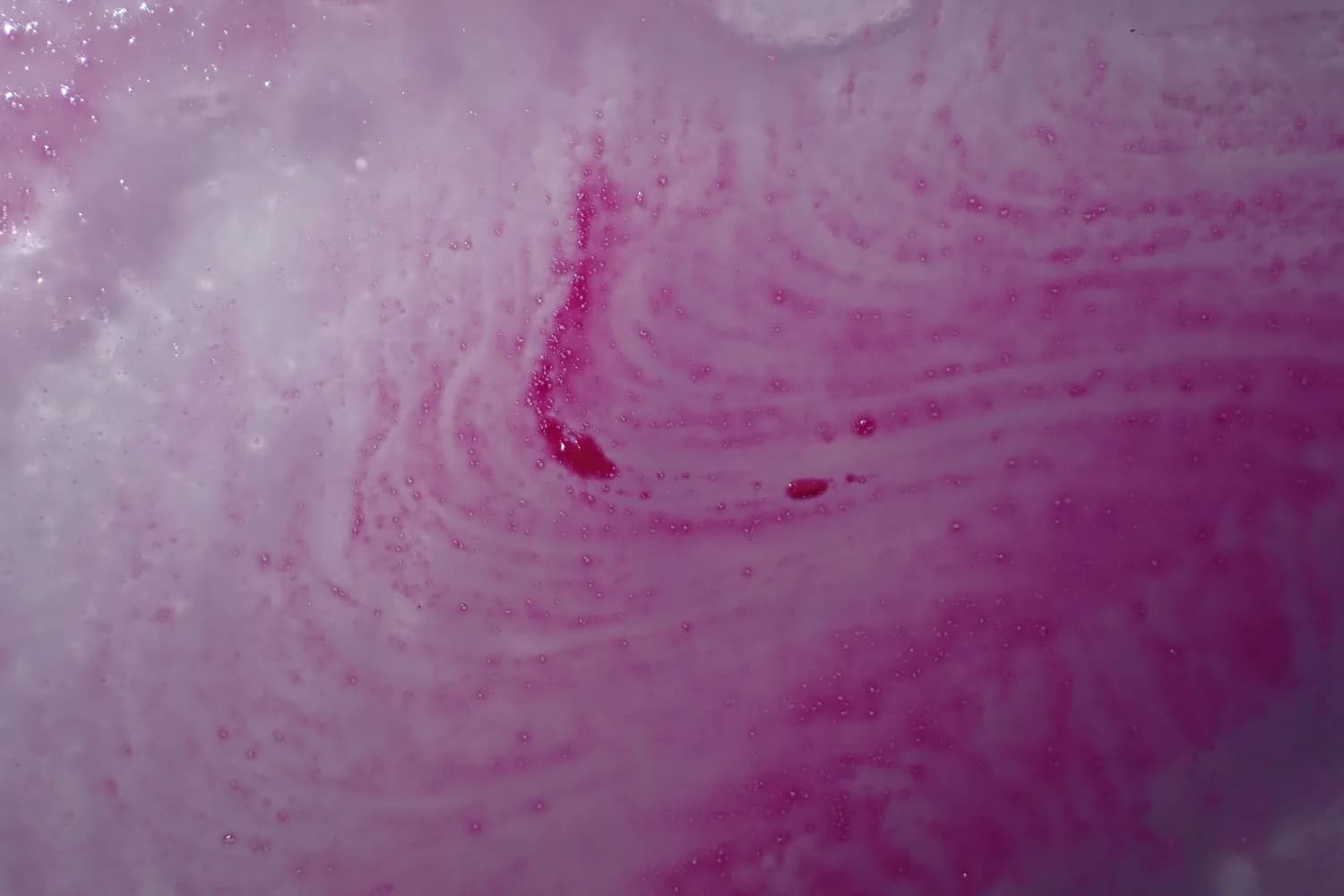 反流性食管炎竟引发口腔溃疡？！