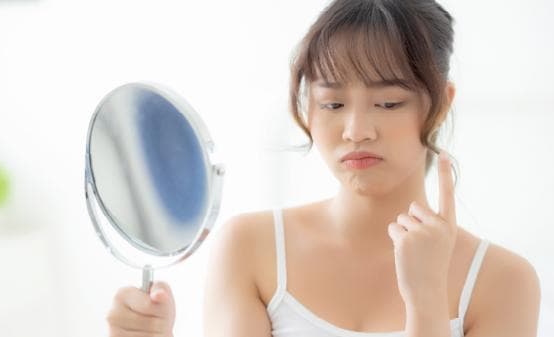 反复长痘吃异维A酸软胶囊控制后，要长期吃来维稳吗？