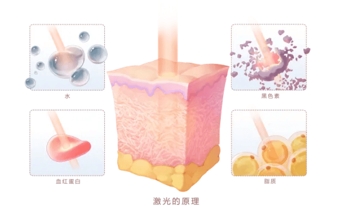 医美大盘点|医美光电治疗术后注意事项大盘点