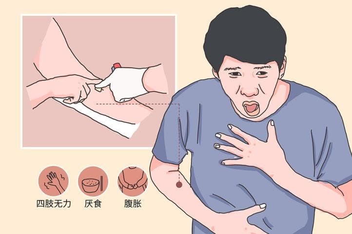 警惕复方甘草片的另一面——低钾血症