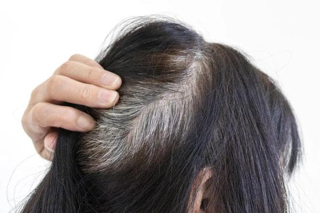 这种被“吹上天”的补充剂，真能使头发变黑吗？