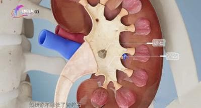 警惕，这些尿液异常可能是癌症的信号