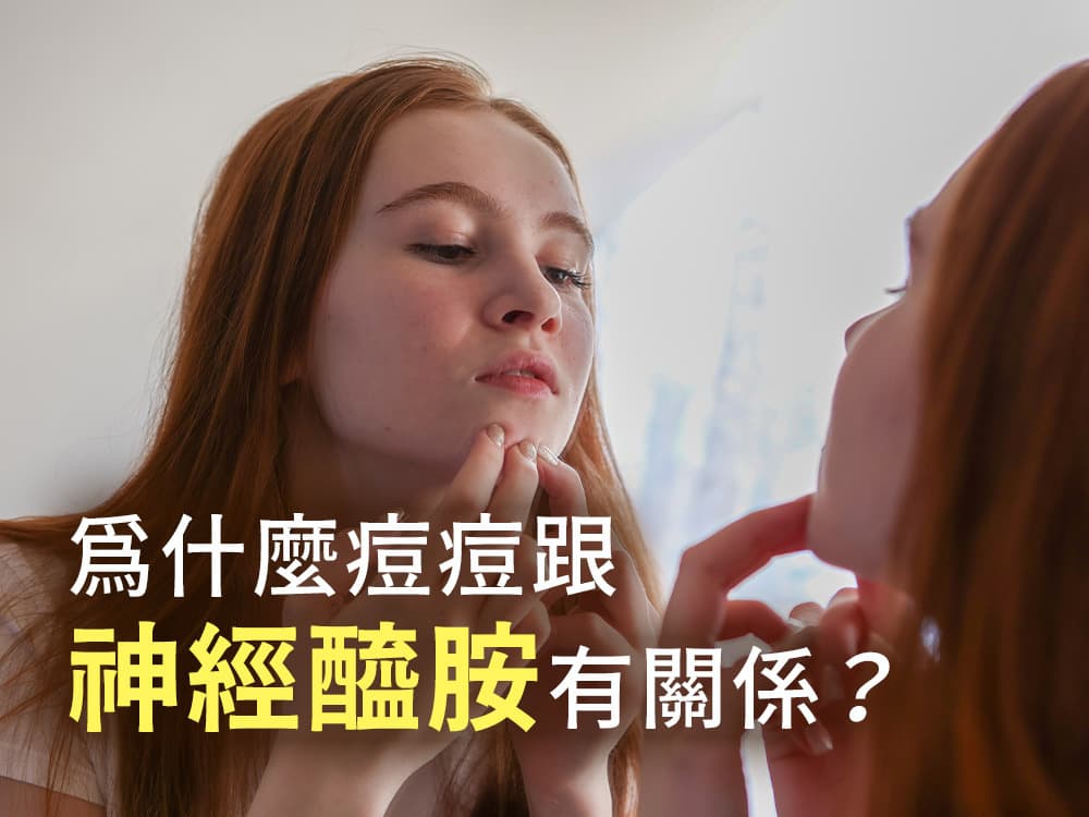 痘痘的起因曝光！神经酰胺是最佳解决方案？挑战！30天「神经酰胺与抗痘」保养计划
