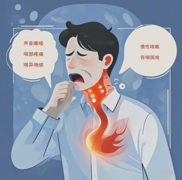 不容忽视！咽喉反流性疾病：导致喉咙长期不适！