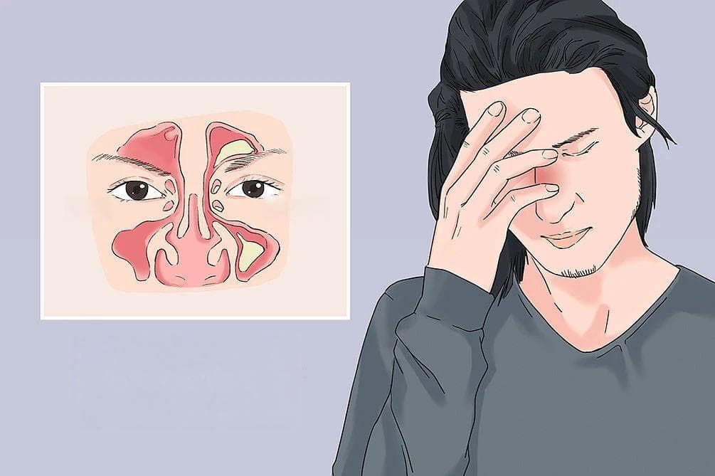 冬季防鼻窦炎，专家教你几招