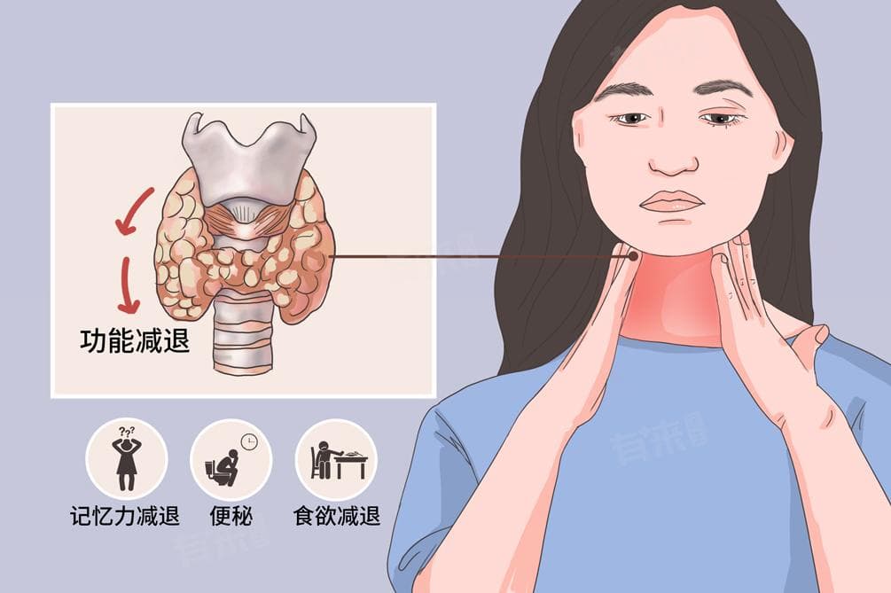 甲减患者该挂哪个科室？一文读懂就医指南
