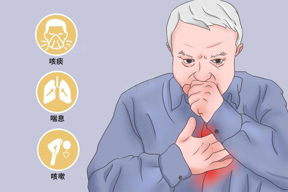 慢性支气管炎最重要的病因是
