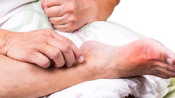 脚部汗臭怎么办？科学护理全攻略