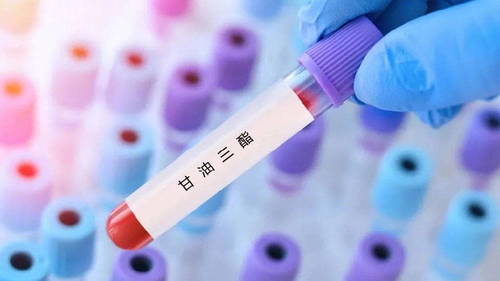 哪些人甘油三酯容易超标？如何科学调控甘油三酯水平?