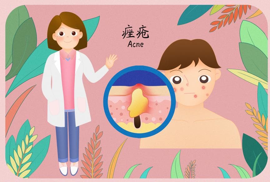 青春不“痘”留——青少年痤疮知识大揭秘