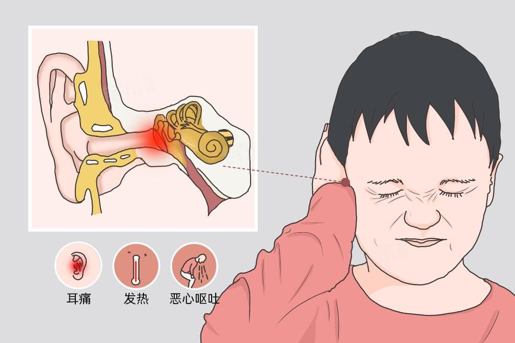 急性中耳炎的治疗方法